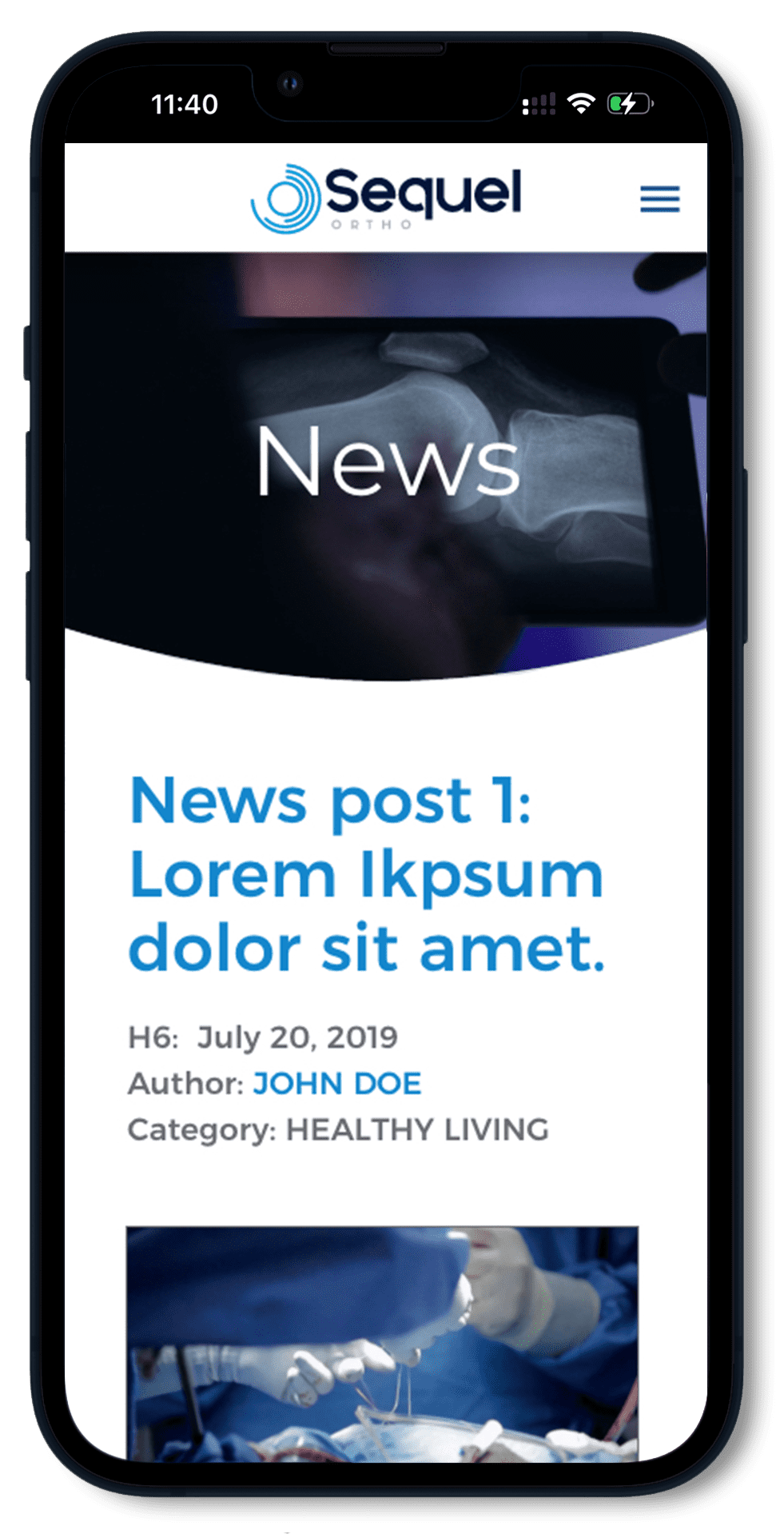 art-phone13-m-sequel-news Sequel Ortho